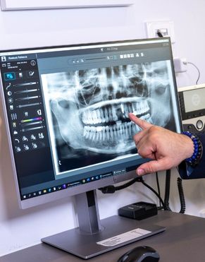 Single Multiple Implants