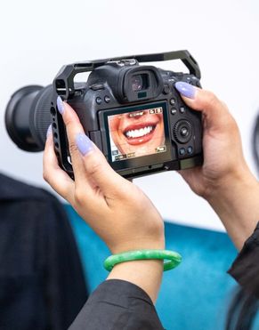 Smile Makeover In Bondi, Bondi Junction, Sydney At Sydney Cosmetic Dentist