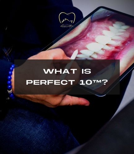 What Is Perfect 10™?