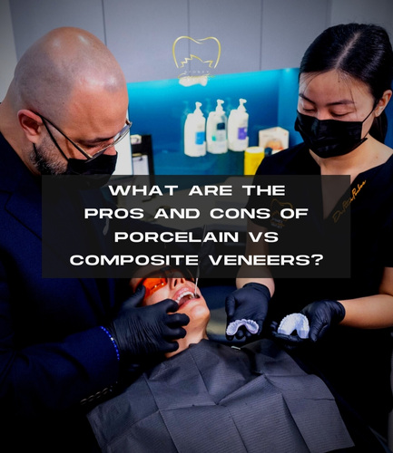 What Are the Pros and Cons of Porcelain vs Composite Veneers?