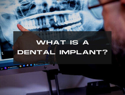 What Is a Dental Implant?