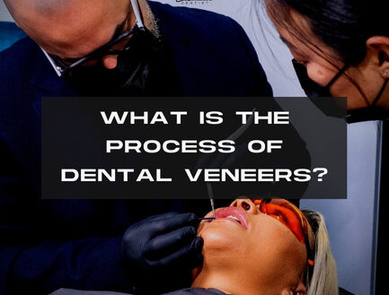 What Is the Process of Dental Veneers?