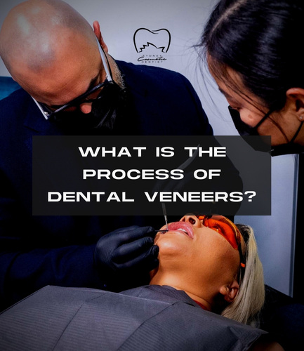 What Is the Process of Dental Veneers?