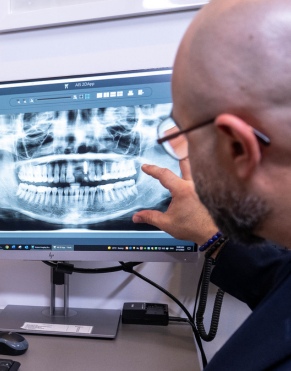 Dental Implant In Bondi, Bondi Junction, Sydney At Sydney Cosmetic Dentist